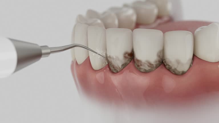 Trusted Teeth Cleaning And Checkup service in Dos Palos, CA - Dentist Open Now